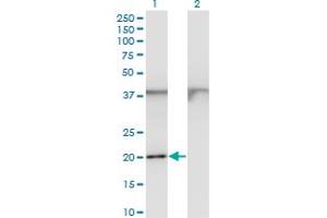 Western Blot analysis of FTL expression in transfected 293T cell line by FTL monoclonal antibody (M15), clone 1C14. (FTL antibody  (AA 1-175))