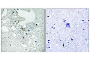 Immunohistochemistry (IHC) image for anti-B-Cell Linker (BLNK) (pTyr84) antibody (ABIN1847670) (B-Cell Linker antibody  (pTyr84))
