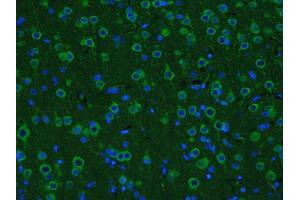 Paraformaldehyde-fixed, paraffin embedded rat brain; Antigen retrieval by boiling in sodium citrate buffer (pH6. (GDNF antibody  (AA 121-211) (FITC))