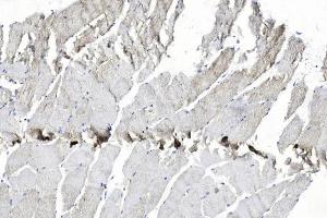 Immunohistochemical analysis of paraffin-embedded Human Skeletal muscle section using Pink1 am7623b. (EPH Receptor B2 antibody)