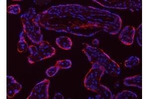 IF analysis of Tropomyosin 2/TPM2 using anti-Tropomyosin 2/TPM2 antibody (ABIN7603245).