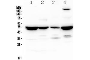 Western blot analysis of Adenylosuccinate Lyase using anti-Adenylosuccinate Lyase antibody .