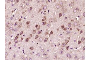 Paraformaldehyde-fixed, paraffin embedded mouse brain, Antigen retrieval by boiling in sodium citrate buffer (pH6) for 15min, Block endogenous peroxidase by 3% hydrogen peroxide for 30 minutes,  Blocking buffer (normal goat serum) at 37°C for 20min, Antibody incubation with VWF Polyclonal Antibody (bs-4754R) at 1:400 overnight at 4°C, followed by a conjugated secondary and DAB staining. (VWF antibody  (AA 351-450))