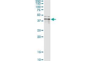 Immunoprecipitation of RNF113B transfected lysate using anti-RNF113B monoclonal antibody and Protein A Magnetic Bead , and immunoblotted with RNF113B MaxPab rabbit polyclonal antibody. (RNF113B antibody  (AA 1-100))