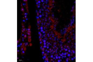 Immunofluorescence of paraffin embedded rat testis using USP27 (ABIN7076113) at dilution of 1:1500 (400x lens) (USP27X antibody)