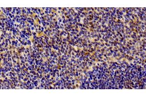 Detection of STAT6 in Rat Spleen Tissue using Polyclonal Antibody to Signal Transducer And Activator Of Transcription 6 (STAT6) (STAT6 antibody  (AA 557-841))