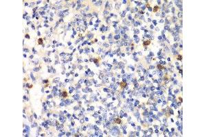 Immunohistochemistry of paraffin-embedded Mouse spleen using PSMD7 Polyclonal Antibody at dilution of 1:100 (40x lens). (PSMD7 antibody)