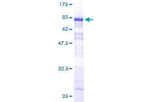 Image no. 1 for Sorting Nexin 25 (SNX25) (AA 1-483) protein (GST tag) (ABIN1320889)