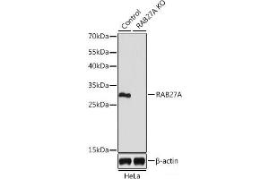 Western blot analysis of extracts from normal (control) and RAB27A knockout (KO) HeLa cells using RAB27A Polyclonal Antibody at dilution of 1:1000. (RAB27A antibody)