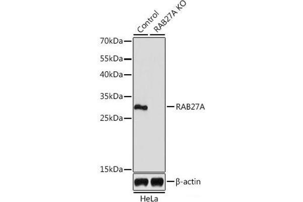RAB27A antibody