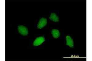 Immunofluorescence of purified MaxPab antibody to RHOXF1 on HeLa cell. (RHOXF1 antibody  (AA 1-184))