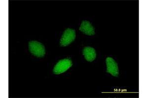 Immunofluorescence of purified MaxPab antibody to RHOXF1 on HeLa cell.