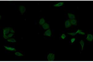 Detection of aZGP1 in Human MCF7 cell using Monoclonal Antibody to Alpha-2-Glycoprotein 1, Zinc Binding (aZGP1) (AZGP1 antibody  (AA 18-296))