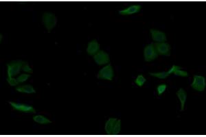 Detection of aZGP1 in Human MCF7 cell using Monoclonal Antibody to Alpha-2-Glycoprotein 1, Zinc Binding (aZGP1) (AZGP1 antibody  (AA 18-296))