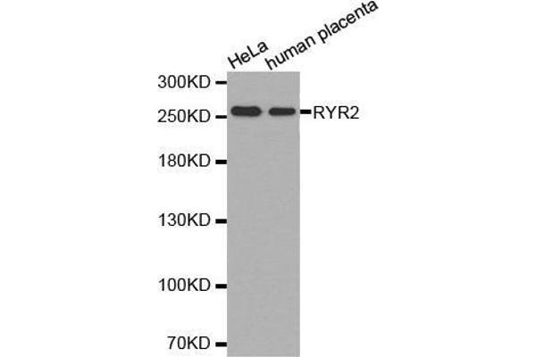 RYR2 Antikörper  (AA 4850-4950)