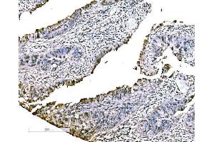 IHC analysis of CBX2 using anti-CBX2 antibody (ABIN7599466). (CBX2 antibody  (AA 1-532))