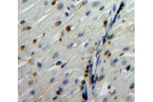 Used in DAB staining on fromalin fixed paraffin-embedded Heart tissue