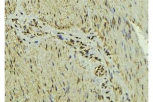 ABIN6277139 at 1/100 staining Mouse muscle tissue by IHC-P. (MAX antibody  (N-Term))
