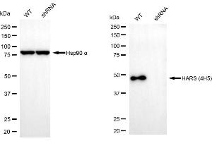 Western blotting analysis using HARS1 antibody (ABIN7798918). (Histidine--tRNA Ligase (HARS-1) antibody)