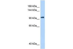 WB Suggested Anti-DHX16 Antibody Titration: 0.