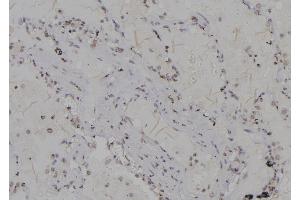 ABIN6266174 and ABIN6277206 at 1/100 staining Human lung tissue by IHC-P. (Histone 3 antibody  (H3K79me3))