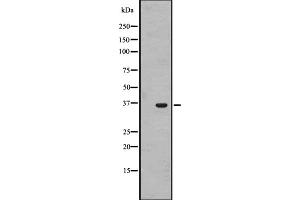Western blot analysis of OR1J4 expression in HL-60 cell line lysate ;,The lane on the left is treated with the antigen-specific peptide. (OR1J4 antibody  (C-Term))