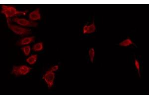 ABIN6274433 staining HeLa by IF/ICC. (ANKK1 antibody  (Internal Region))