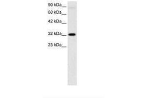 Image no. 3 for anti-Mesenchyme Homeobox 1 (MEOX1) (AA 38-87) antibody (ABIN6735804) (MEOX1 antibody  (AA 38-87))