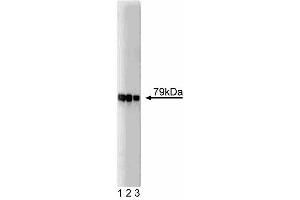 Western blot analysis of AKAP79 on SW13 lysate. (AKAP5 antibody  (AA 180-427))