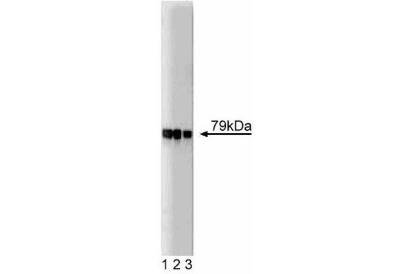 AKAP5 Antikörper  (AA 180-427)