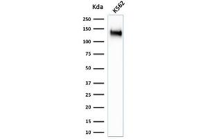 Western Blotting (WB) image for anti-Sialophorin (SPN) antibody (ABIN6940641)