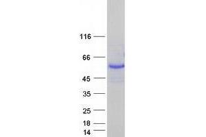 Ubiquitin Specific Peptidase 27, X-Linked (USP27X) protein (Myc-DYKDDDDK Tag)