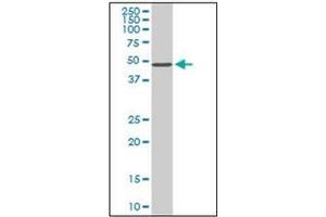 Western Blotting (WB) image for anti-serine/threonine Kinase 38 (STK38) (AA 365-466) antibody (ABIN954986) (STK38 antibody  (AA 365-466))