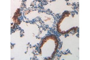 IHC-P analysis of lung tissue, with DAB staining. (MUC5B antibody  (AA 3667-3771))
