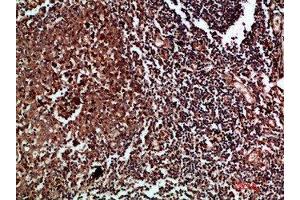 Immunohistochemical analysis of paraffin-embedded human-tonsil, antibody was diluted at 1:200 (CDK6 antibody  (AA 280-325))