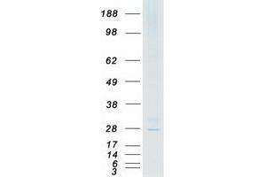 Validation with Western Blot (CACNG6 Protein (Transcript Variant 1) (Myc-DYKDDDDK Tag))