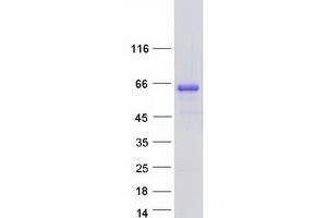 Validation with Western Blot (AHCYL2 Protein (Transcript Variant 2) (Myc-DYKDDDDK Tag))