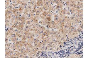 Immunohistochemical staining of paraffin-embedded Human bladder tissue using anti-PECR mouse monoclonal antibody.