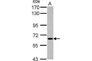 WB Image Sample (30 ug of whole cell lysate) A: HepG2 7. (ACVR1C/ALK7 antibody  (Center))
