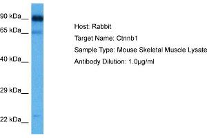 Host:  Rabbit  Target Name:  CTNNB1  Sample Tissue:  Mouse Skeletal Muscle  Antibody Dilution:  1ug/ml (CTNNB1 antibody  (C-Term))