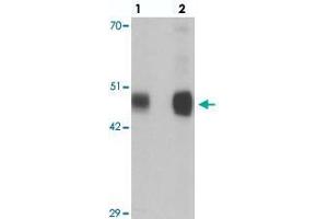 Western blot analysis of RILPL1 in rat cerebellum tissue with RILPL1 polyclonal antibody  at (lane 1) 0. (RILPL1 antibody  (N-Term))