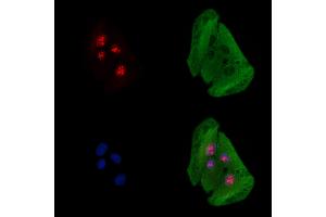 ABIN6261546 and ABIN6278460 staining  cells by IF/ICC. (EOMES antibody  (C-Term))