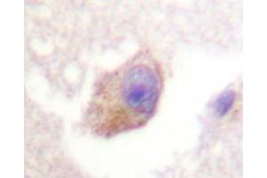 Immunohistochemistry analyzes of TPH1 antibody in paraffin-embedded human brain tissue. (Tryptophan Hydroxylase 1 antibody)