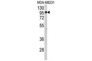 Western blot analysis of BAHD1 Antibody (C-term) in MDA-MB231 cell line lysates (35µg/lane). (BAHD1 antibody  (C-Term))