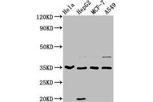 Western Blot Positive WB detected in: Hela whole cell lysate, HepG2 whole cell lysate, MCF-7 whole cell lysate, A549 whole cell lysate All lanes: AIMP1 antibody at 3.
