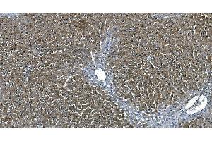 IHC analysis of ASS1 using anti-ASS1 antibody (ABIN7601192).