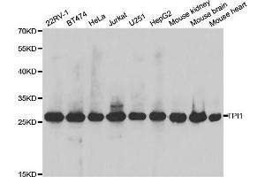 Western blot analysis of extracts of various cell lines, using TPI1 antibody. (TPI1 antibody)
