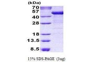 Figure annotation denotes ug of protein loaded and % gel used. (Cytokeratin 19 Protein)