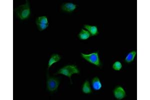 Immunofluorescence staining of MCF-7 cells with ABIN7165166 at 1:166, counter-stained with DAPI. (C19ORF12 antibody  (AA 65-104))