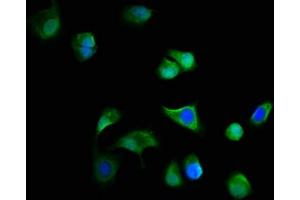 Immunofluorescence staining of MCF-7 cells with ABIN7165166 at 1:166, counter-stained with DAPI.